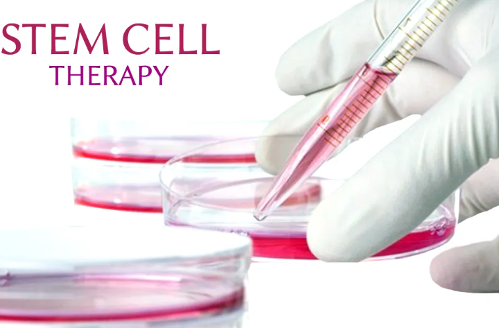 Stem Cell Revolution: Transforming Multiple Sclerosis Treatment