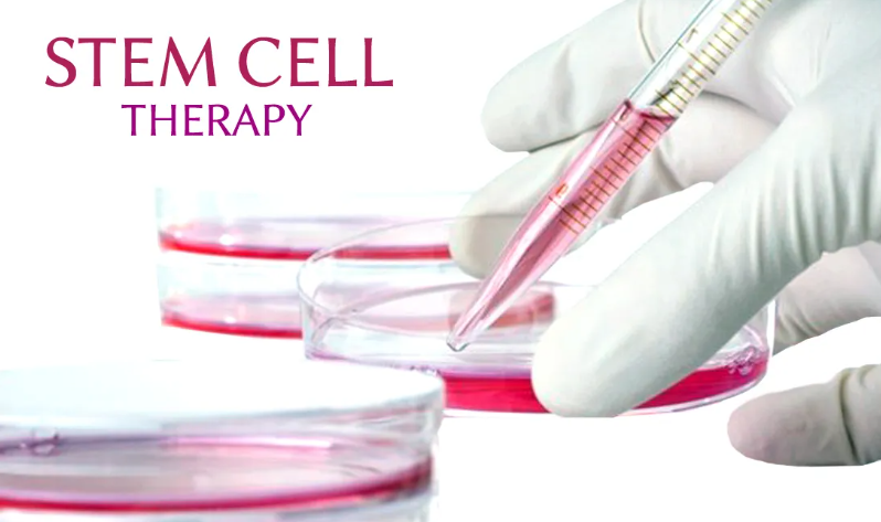 Stem Cell Revolution: Transforming Multiple Sclerosis Treatment