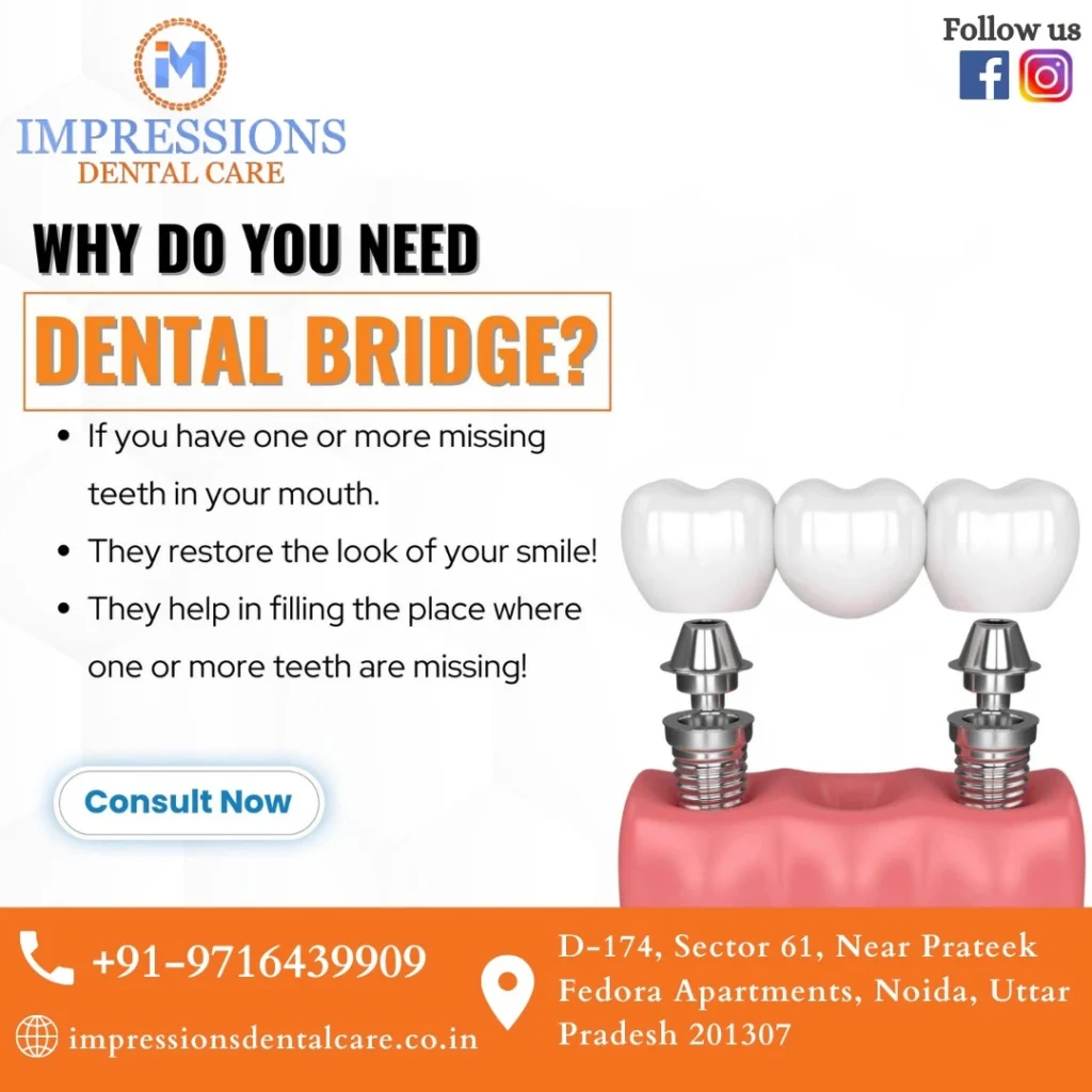 Best Dentist Near Me Noida Impression Dental