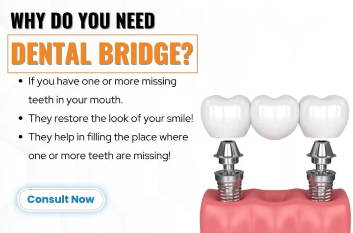 Best Dentist Near Me Noida Impression Dental